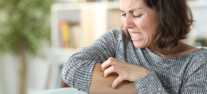 Skin Rashes During Menopause Explained