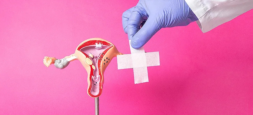 Fibroids and their Journey Post-Menopause